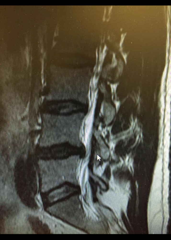 How to Improve Your Sleep Posture and Reduce Neck and Back Pain